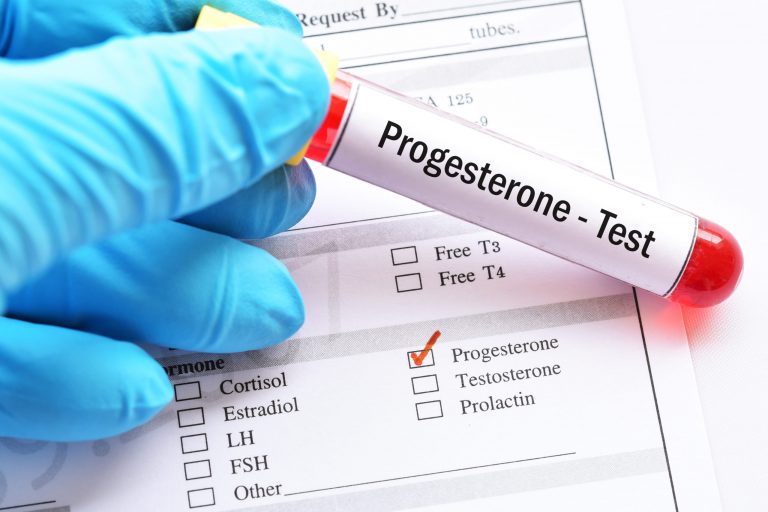 ما هو تحليل progesterone؟