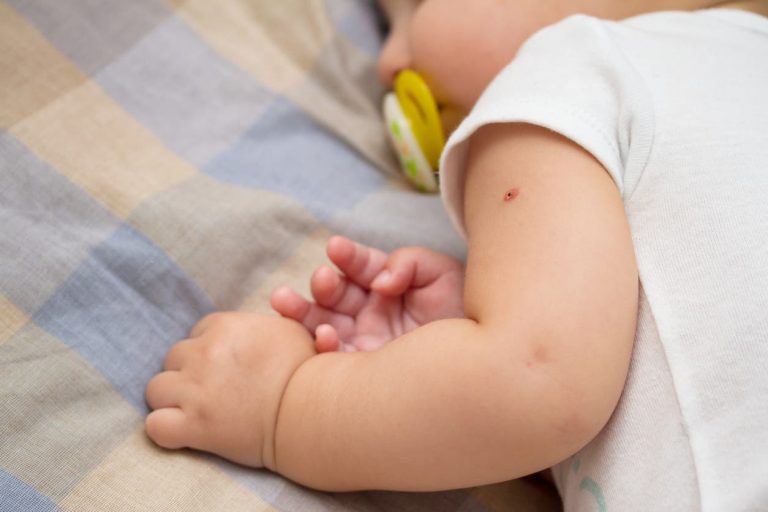 متى تؤخذ 3 الجرعات من تطعيم الدرن للأطفال؟