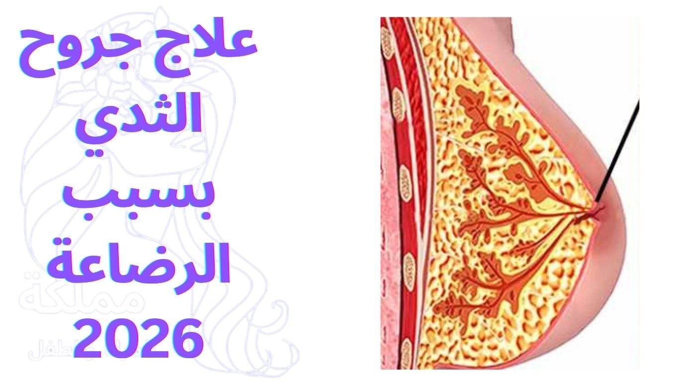 علاج جروح الثدي بسبب الرضاعة 2026