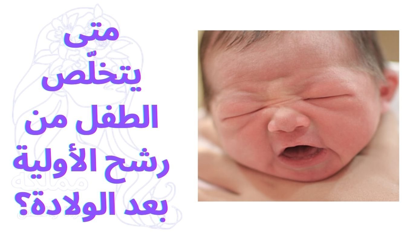 متى يتخلّص الطفل من رشح الأولية بعد الولادة؟