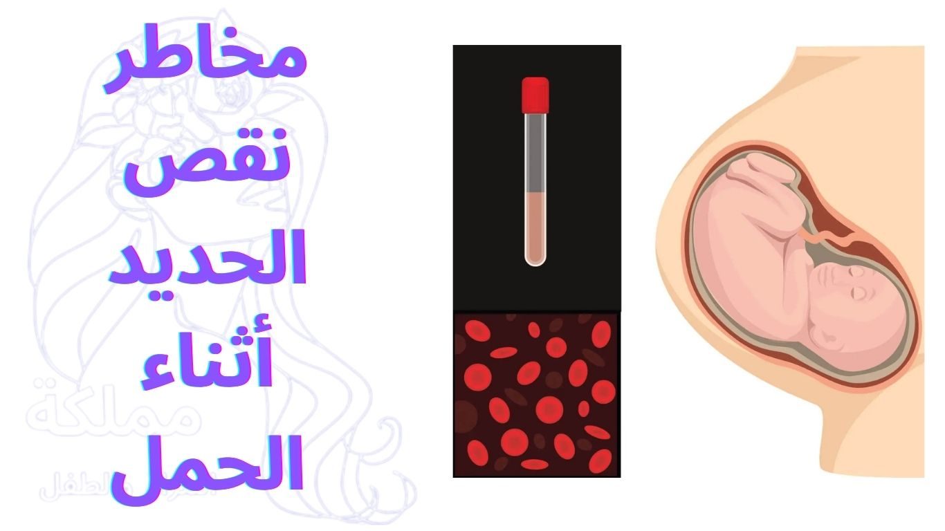 مخاطر نقص الحديد أثناء الحمل