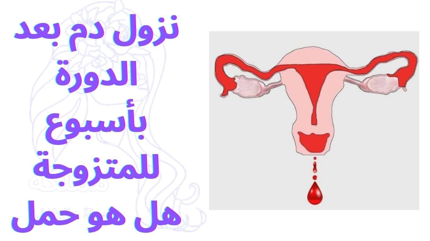 نزول دم بعد الدورة بأسبوع للمتزوجة هل هو حمل