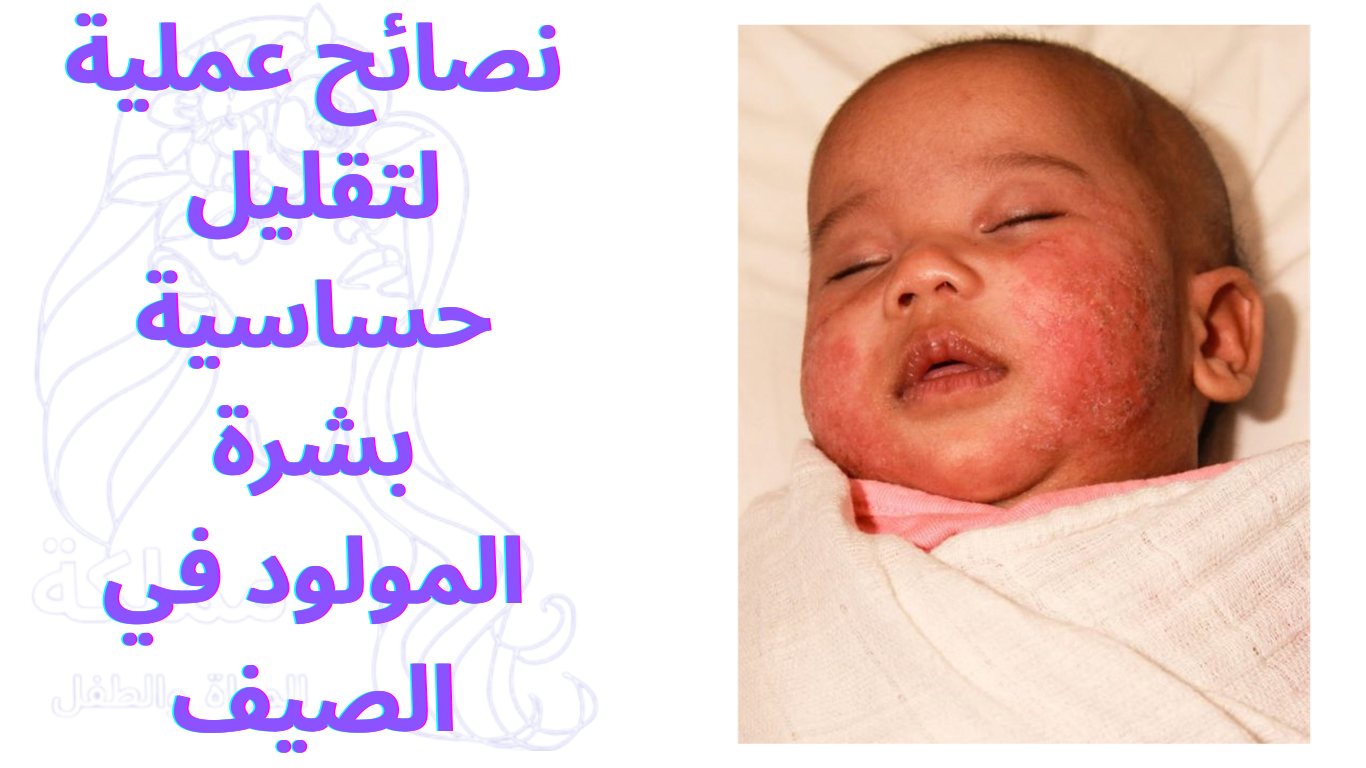 نصائح عملية لتقليل حساسية بشرة المولود في الصيف