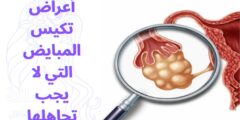 أعراض تكيس المبايض التي لا يجب تجاهلها