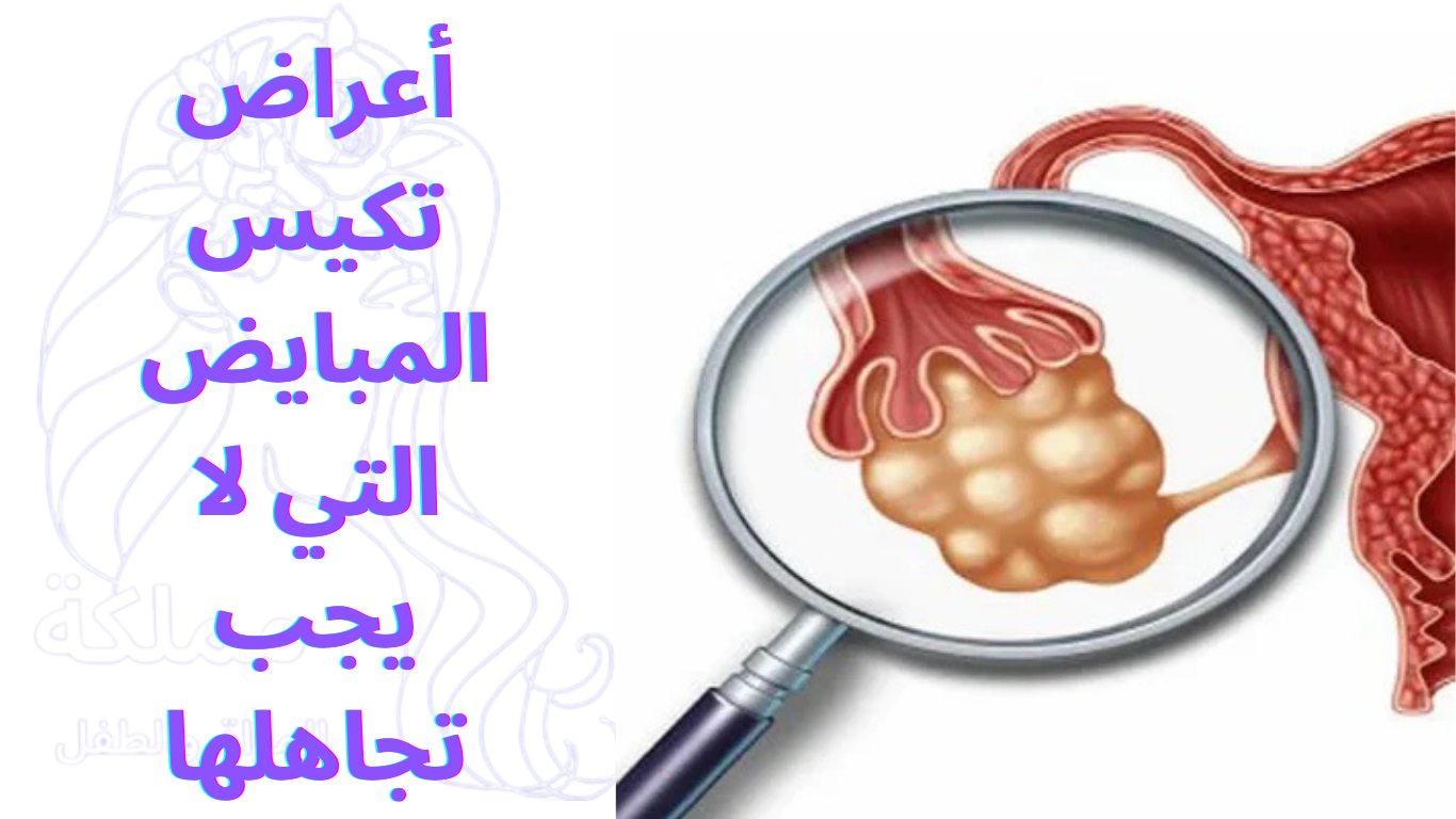 أعراض تكيس المبايض التي لا يجب تجاهلها