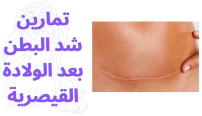 تمارين شد البطن بعد الولادة القيصرية
