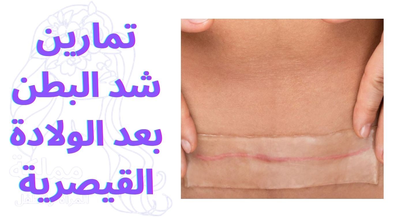 تمارين شد البطن بعد الولادة القيصرية