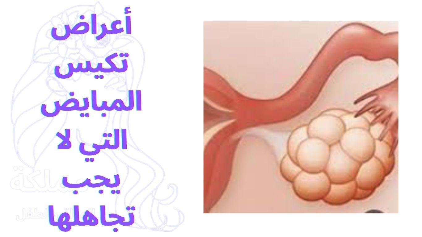أعراض تكيس المبايض التي لا يجب تجاهلها