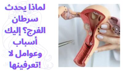 لماذا يحدث سرطان الفرج؟ إليك أسباب وعوامل لا تعرفينها!