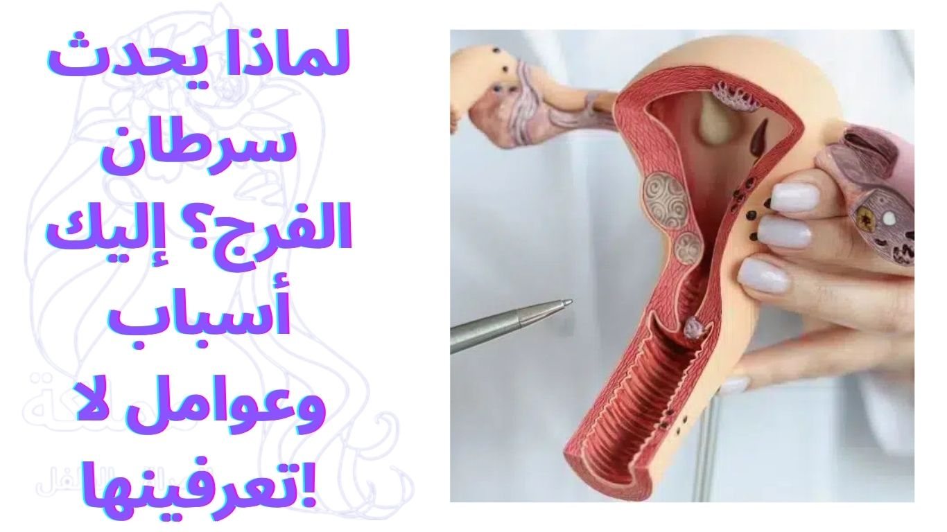 لماذا يحدث سرطان الفرج؟ إليك أسباب وعوامل لا تعرفينها!