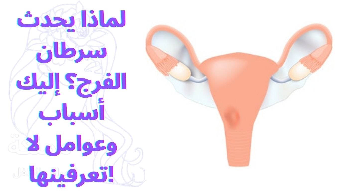 لماذا يحدث سرطان الفرج؟ إليك أسباب وعوامل لا تعرفينها!