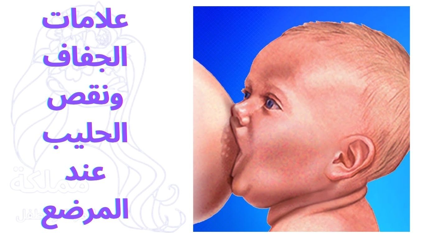 علامات الجفاف ونقص الحليب عند المرضع