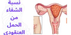 نسبة الشفاء من الحمل العنقودي