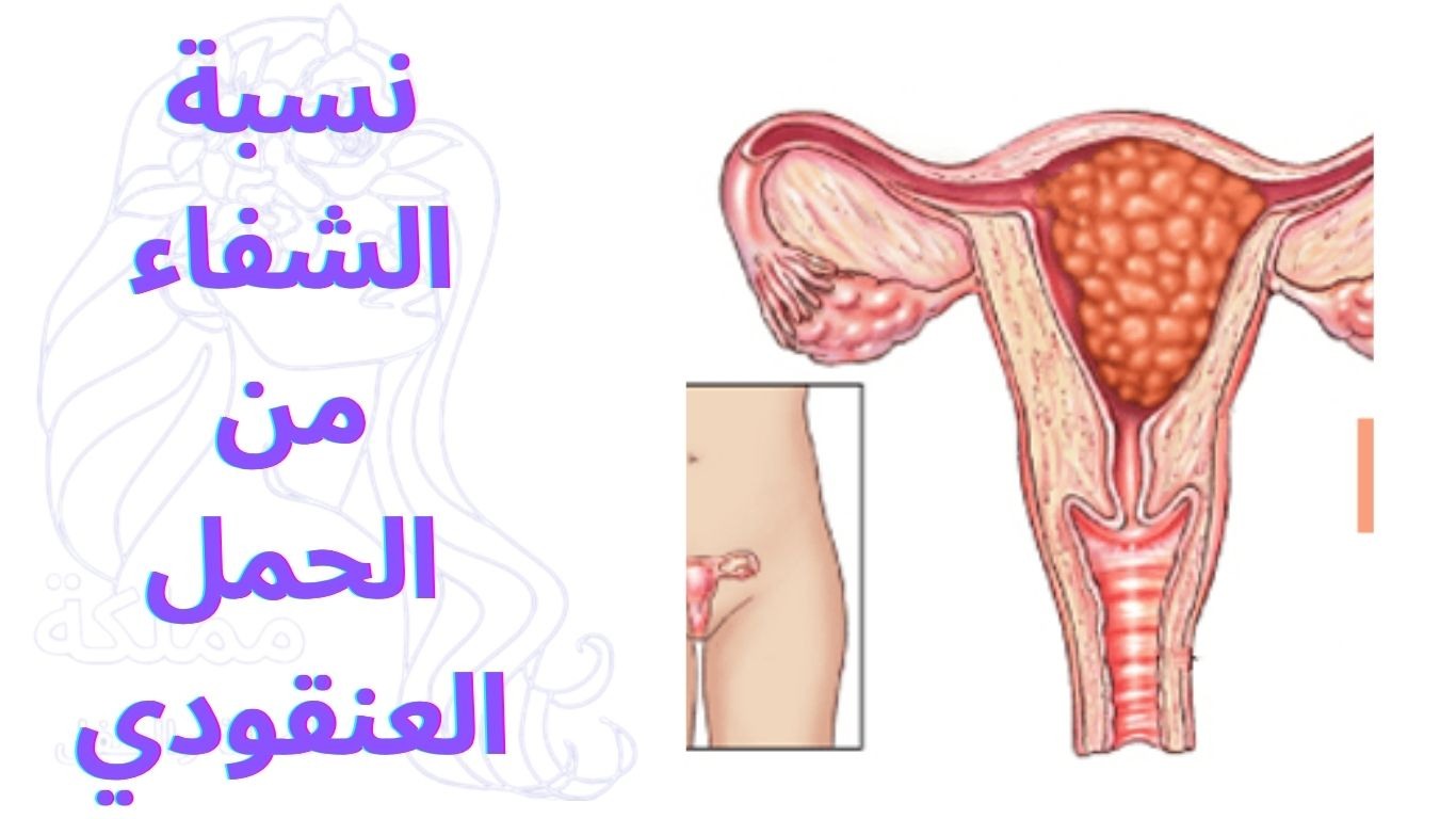 نسبة الشفاء من الحمل العنقودي