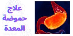 علاج حموضة المعدة