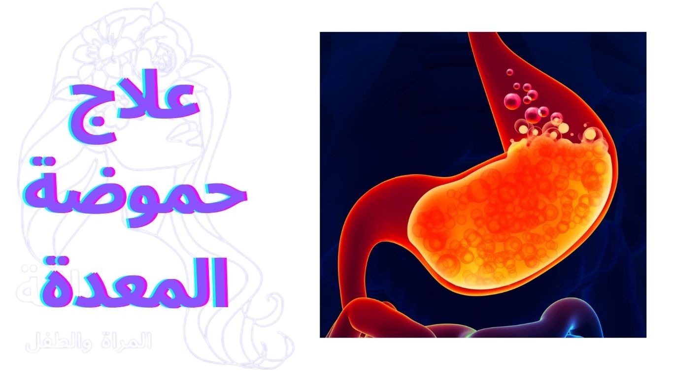 علاج حموضة المعدة