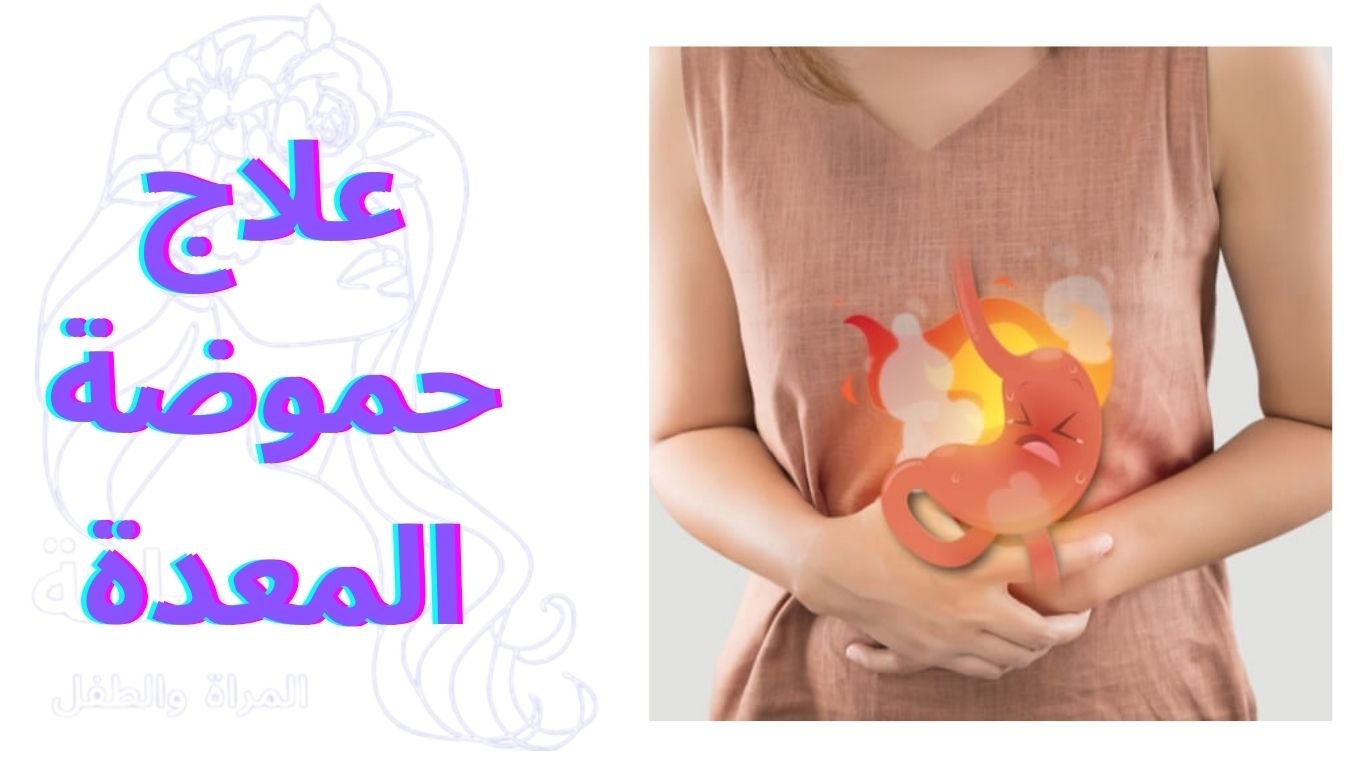 علاج حموضة المعدة