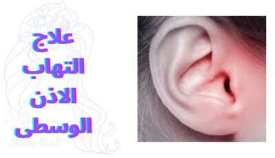 علاج التهاب الاذن الوسطى