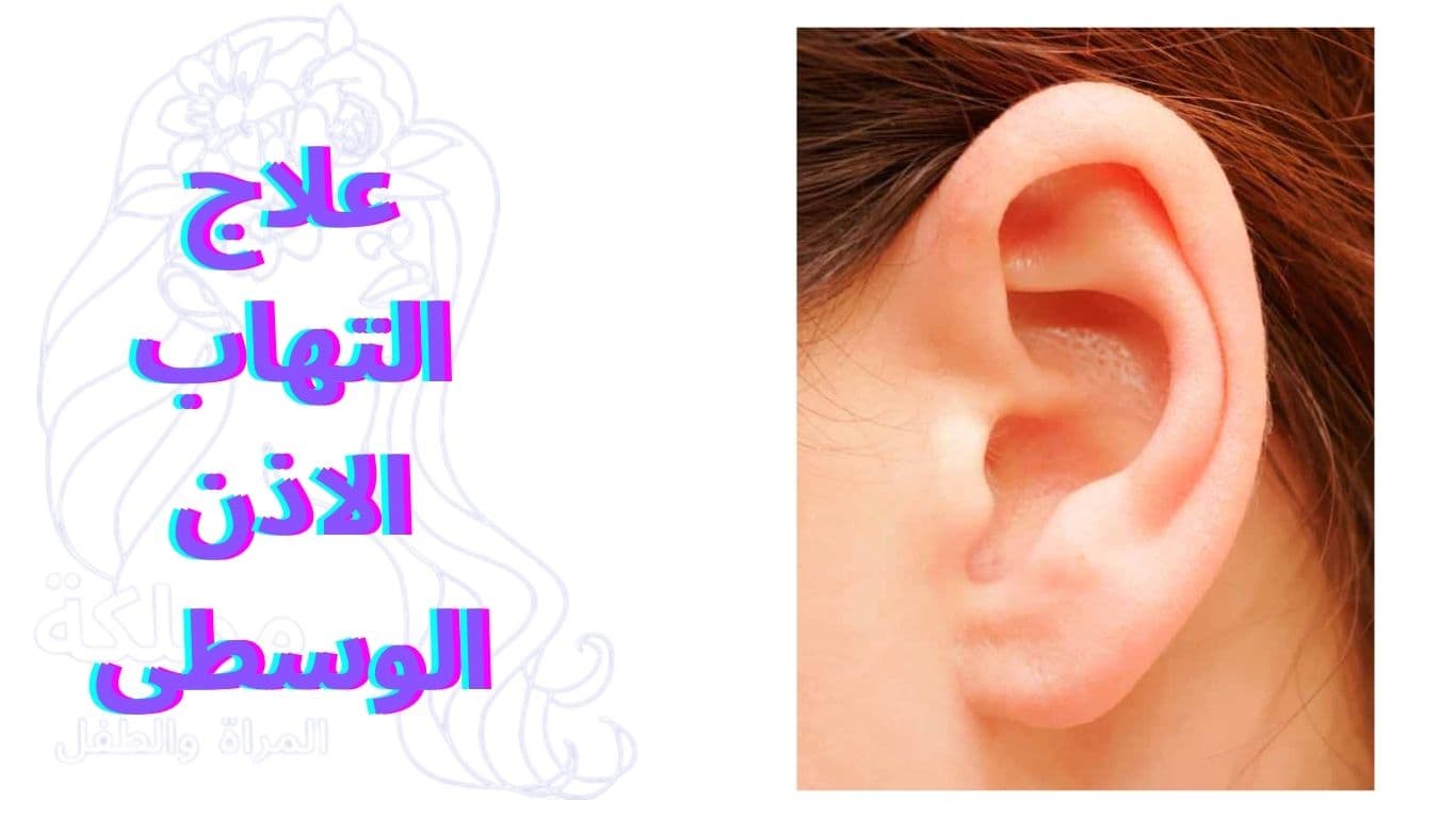 علاج التهاب الاذن الوسطى