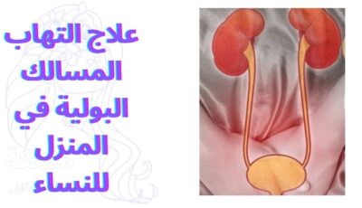 علاج التهاب المسالك البولية في المنزل للنساء