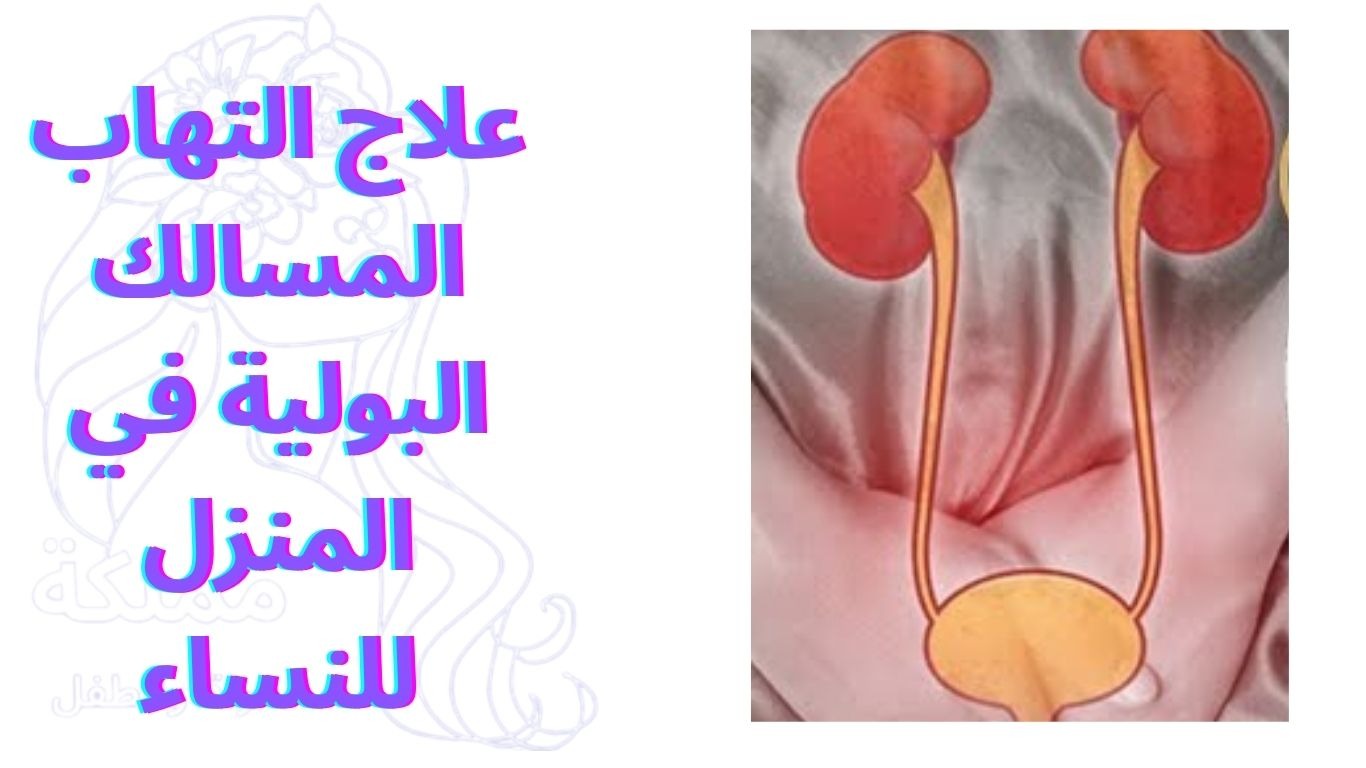 علاج التهاب المسالك البولية في المنزل للنساء