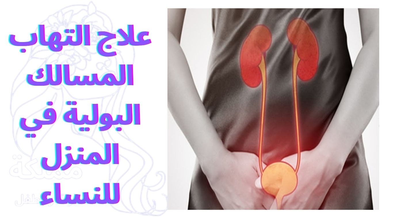 علاج التهاب المسالك البولية في المنزل للنساء