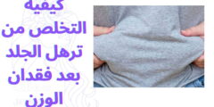 كيفية التخلص من ترهل الجلد بعد فقدان الوزن