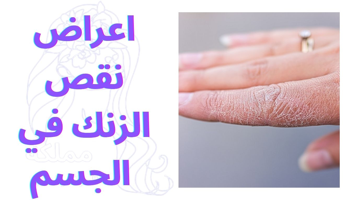 اعراض نقص الزنك في الجسم