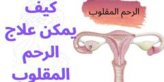 كيف يمكن علاج الرحم المقلوب
