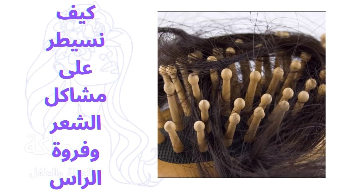 كيف نسيطر على مشاكل الشعر وفروة الراس